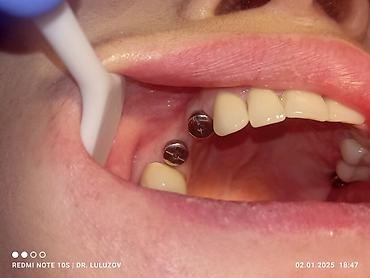 Медицинские услуги: Клиника | Стоматолог | Протезирование — 2