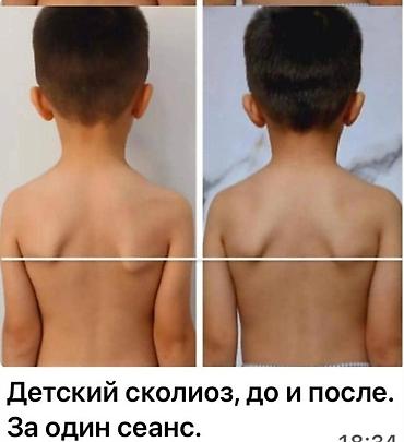 Массаж: Массаж | Спортивный массаж | Сутулость, нарушение осанки — 2