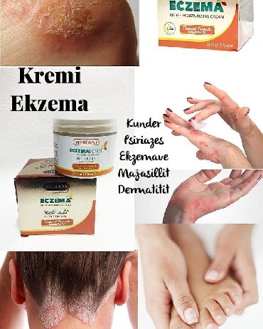 Saçlara qulluq: Eczema quru, qaşınan və qıcıqlanmış dəridən qurtuluş təmin edən zərif