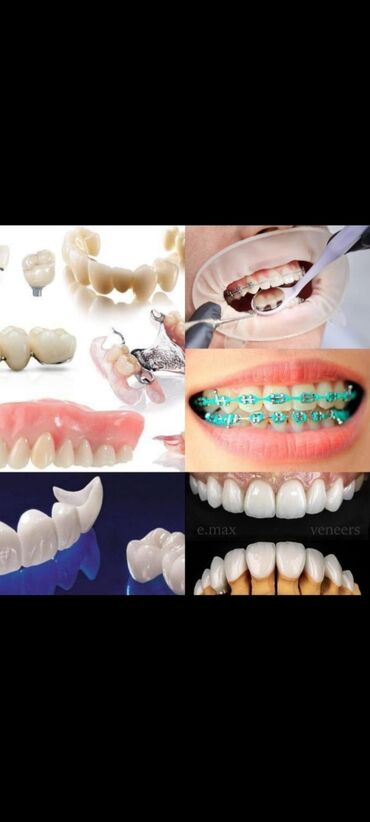 Стоматолог | Реставрация, Протезирование, Чистка зубов | Консультация