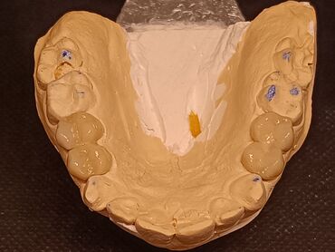 İşıqlandırma: Məhsul: Smartfon üçün diş həkimi çəkiliş seti – LED halqa işıqlı — 8