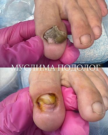 дезинфектор: Подологические услуги Специалист: Муслима — подолог. Направления — 8