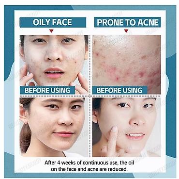 Уход за телом: ❄️ США Крем с керамидами антивозрастной увлажняющий Крем с керамидами — 5