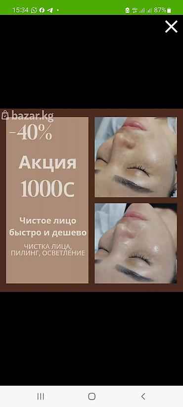 очистка мор: Чистка лица + пилинг для осветления Комплексная процедура — 8