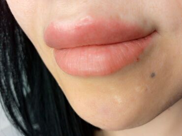 Косметология: Косметология, Биоревитализация, Ботулинотерапия, Контурное моделирование, Гипоаллергенные материалы, Консультация, Сертифицированный косметолог — 20