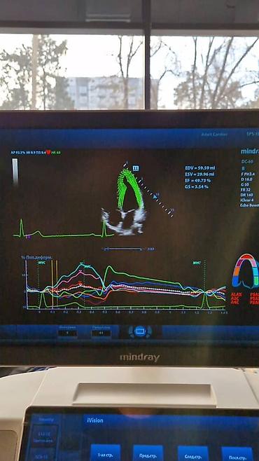 Медицинское оборудование: Продаётся УЗИ аппарат экспертного класса Mindray DC-80 X-INSIGHT — 10