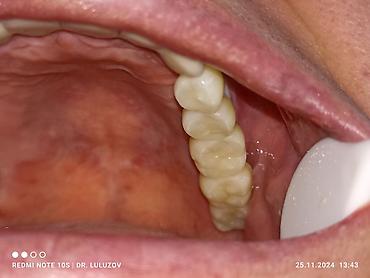 Медицинские услуги: Клиника | Стоматолог | Протезирование — 15