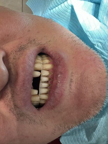 художественная реставрация зубов композитными материалами: Врачи, Клиника | Стоматолог | Протезирование, Диагностика, Консультация