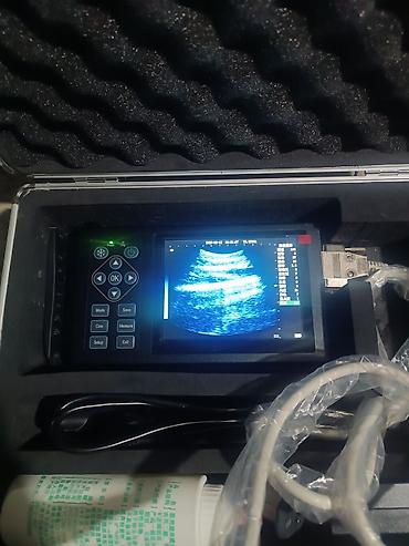 esa: Daşınan ultrasəs diaqnostika cihazı (portable USG) Xüsusiyyətlər: - — 3