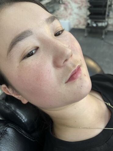 Косметология: Косметология, Маски, Мезотерапия, Удаление носогубных складок, Гипоаллергенные материалы, Консультация, Сертифицированный косметолог — 89