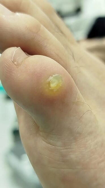 Маникюр, педикюр: Коррекция вросших ногтей, Педикюр, Услуги подолога, Консультация, Одноразовые расходные материалы — 11