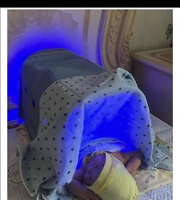Медицинские лампы: Домашний фототерапевтический бокс для новорождённых — 2