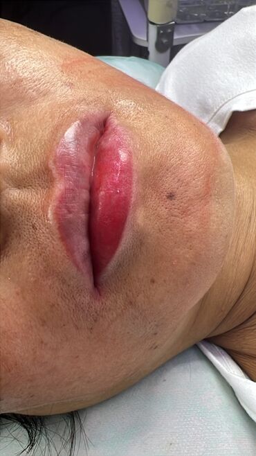 Косметология: Косметология, Маски, Мезотерапия, Удаление носогубных складок, Гипоаллергенные материалы, Консультация, Сертифицированный косметолог — 27