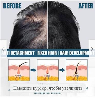 Уход за телом: США против выпадения волос ouhoe от облысения восстанавливающий спрей — 8