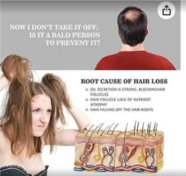 Уход за телом: США для роста волос от облысения - читаем обьявление смотрим фото — 6