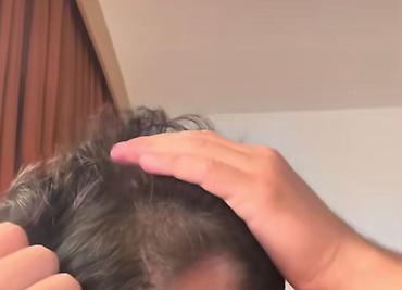 at cilovu: EMBEAUTY 9 Aktivli – Dökülən və gec uzayan saçlar üçün dolğunlaşdırıcı — 3