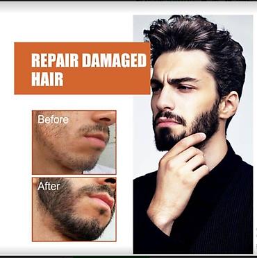 Уход за телом: США для роста волос для бороды от облысения от алопеции от — 6