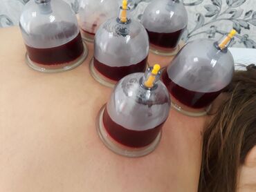 лечебный массаж бишкек in Кыргызстан | МАССАЖ: Хиджама жасайбыз. Адес: Фрунзе+ 2этаж,7каб.Токтогулова,Бейшеналиева та