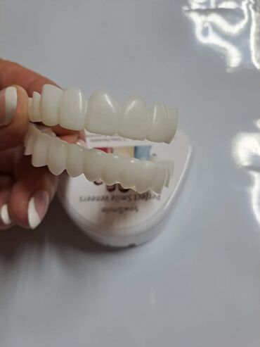 Ostali medicinski proizvodi: Snap on Smile navlake za zube Cena:2000din/gornja ili donja na lalafo.rs — 5 Ostali medicinski proizvodi: Snap on Smile navlake za zube Cena:2000din/gornja ili donja — 5