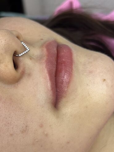 Косметология: Косметология, Ботокс, Биоревитализация, Ботулинотерапия, Консультация, Гипоаллергенные материалы, Сертифицированный косметолог — 27