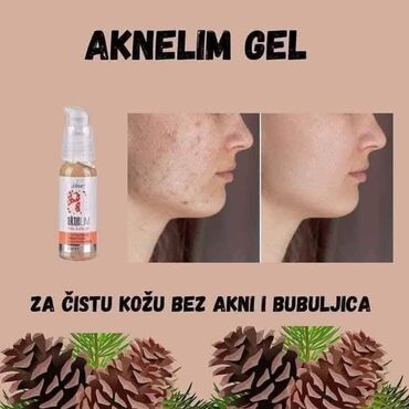 Nega kože: Aknelim gel 30ml – 100% delotvoran saveznik protiv akni Iskoristite — 8