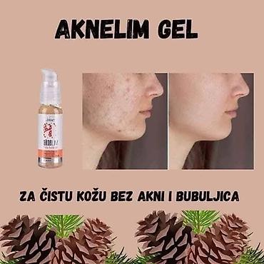 Nega kože: Aknelim gel 30ml – 100% delotvoran saveznik protiv akni Iskoristite — 12