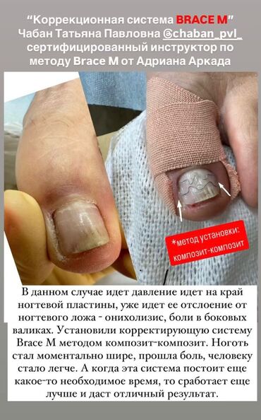 Маникюр, педикюр: Ремонт сломаных ногтей, Снятие, Укрепление ногтей, Услуги подолога, Одноразовые расходные материалы, Консультация, С выездом на дом — 6