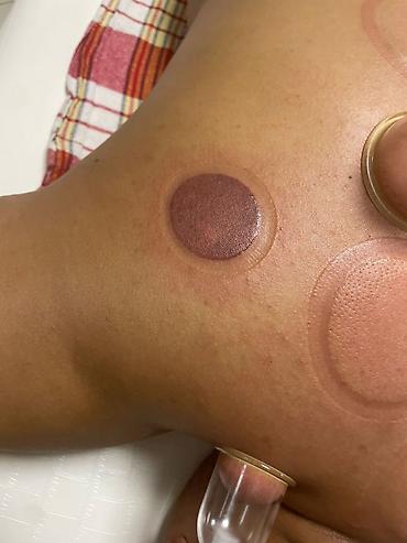 Массаж: Массаж | Сутулость, нарушение осанки — 3