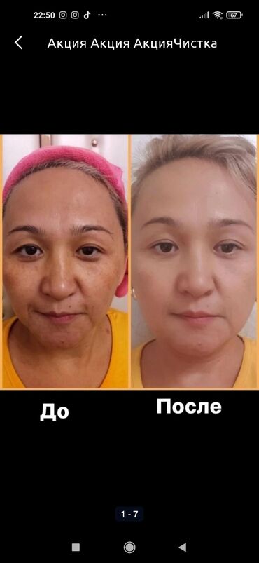 уход за лицом после 25 в Кыргызстан | Уход за телом: Косметолог | Лифтинг