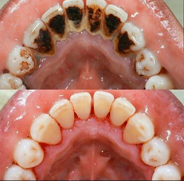 рентген зубов in Кыргызстан | МЕДИЦИНСКОЕ ОБОРУДОВАНИЕ: Стоматолог | Реставрация, Протезирование, Чистка зубов | Круглосуточно