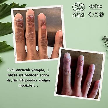 Gözəllik və sağlamlıq: Təbii, organik, lavanda gülündən hazırlanmış kremlər. 7 viddə var — 10