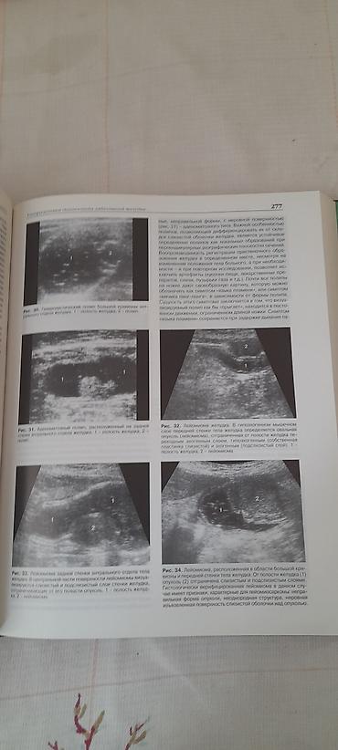 Kitablar və jurnallar: Məhsul: Kitab – “Практическое руководство по ультразвуковой — 3