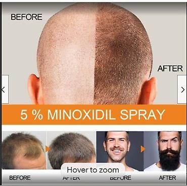 фильер: От Выпадения волос облысения США Minoxidil Оригинал прямые поставки — 7