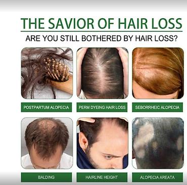 Уход за телом: США Многофункциональное 100% эфирное масло розмарина - прямые поставки — 14