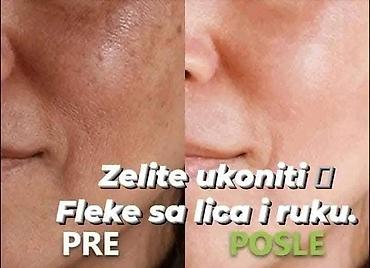 Nega kože: 👑 Limes 21 – krema koja je osvojila lice mnogih žena. i izbor za — 17