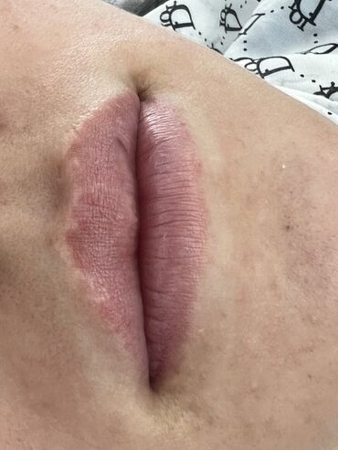 Косметология: Косметология, Маски, Мезотерапия, Удаление носогубных складок, Гипоаллергенные материалы, Консультация, Сертифицированный косметолог — 79