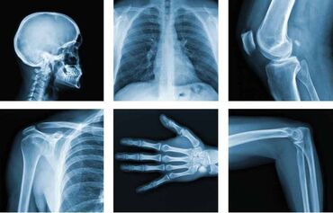 купить iqos в бишкеке: Куплю рентген пленку Использованные снимки В любом количестве
