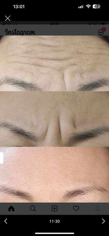 Косметология: Косметология, Биоревитализация, Ботокс, Демодекоз, Гипоаллергенные материалы, Консультация, Сертифицированный косметолог — 8