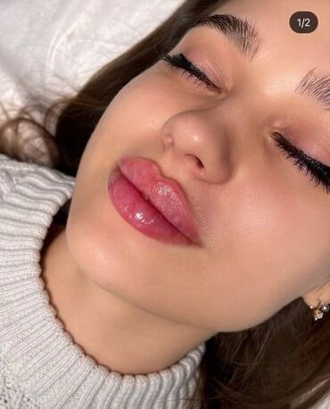 печать без документов: Косметология, Увеличение губ, Гипоаллергенные материалы