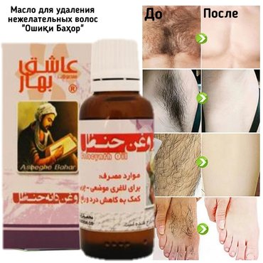 Шуморо мӯиҳои зиёдати азият медиҳад? Дар тӯю маъракаҳо озод нишаста