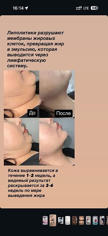 Косметология, Консультация, Гипоаллергенные материалы, Сертифицированный косметолог