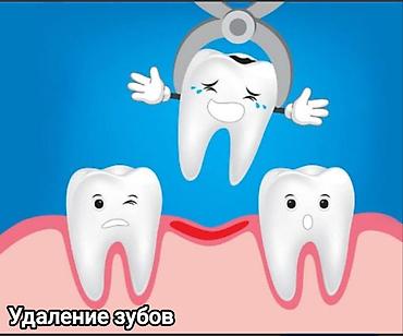 Стоматологи: Съёмные зубные протезы под ваши задачи - Вакуумные протезы: плотная — 12