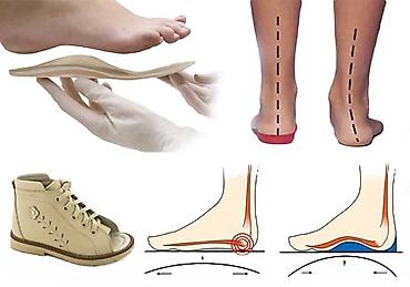 foot patch: Стельки ортопедические(специализированные) от плоскостопия! Для — 2