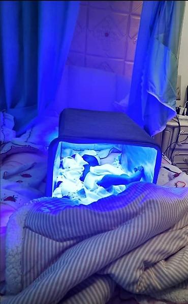 цветные лампы: Фотолампа наристелердин желтухасын үй шартында эффективдүү кетирүүчү — 2