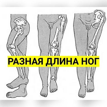 foot patch: Стельки для роста (7 видов) Цена за пару от 1100 до 1600 сом — 9