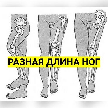 стелька: Стельки для роста (7 видов) Адрес: Лермонтова — 2