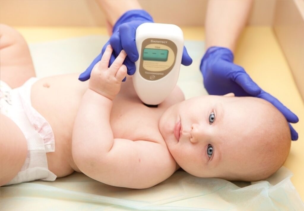 билирубина билитест. билирубина билитест. анализатор гипербилирубинемии фотометрический «билитест». билитест агф-02. билирубина билитест.