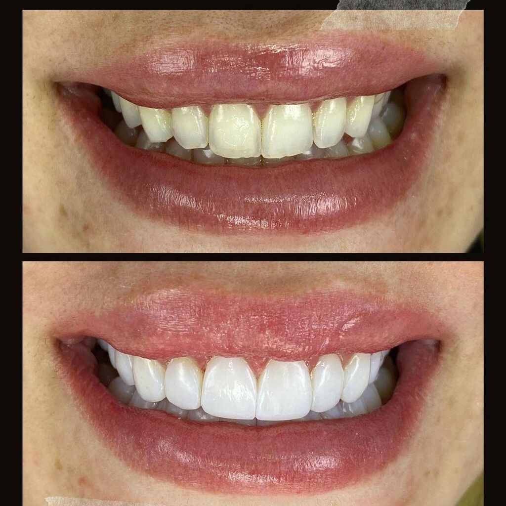 Peşəkar stomatoloji xidmətlər - 2