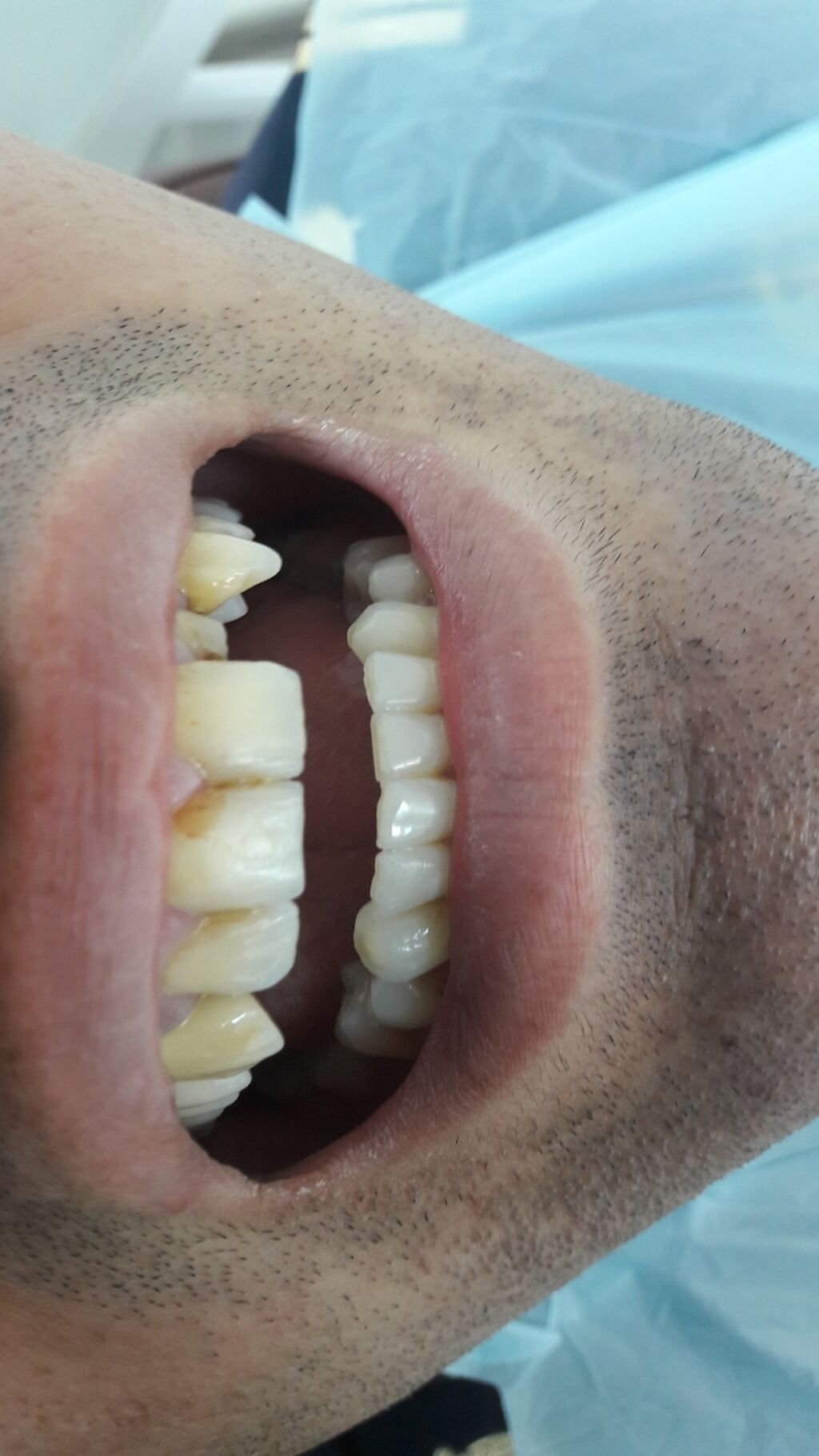 Peşəkar stomatoloji xidmətlər - 4