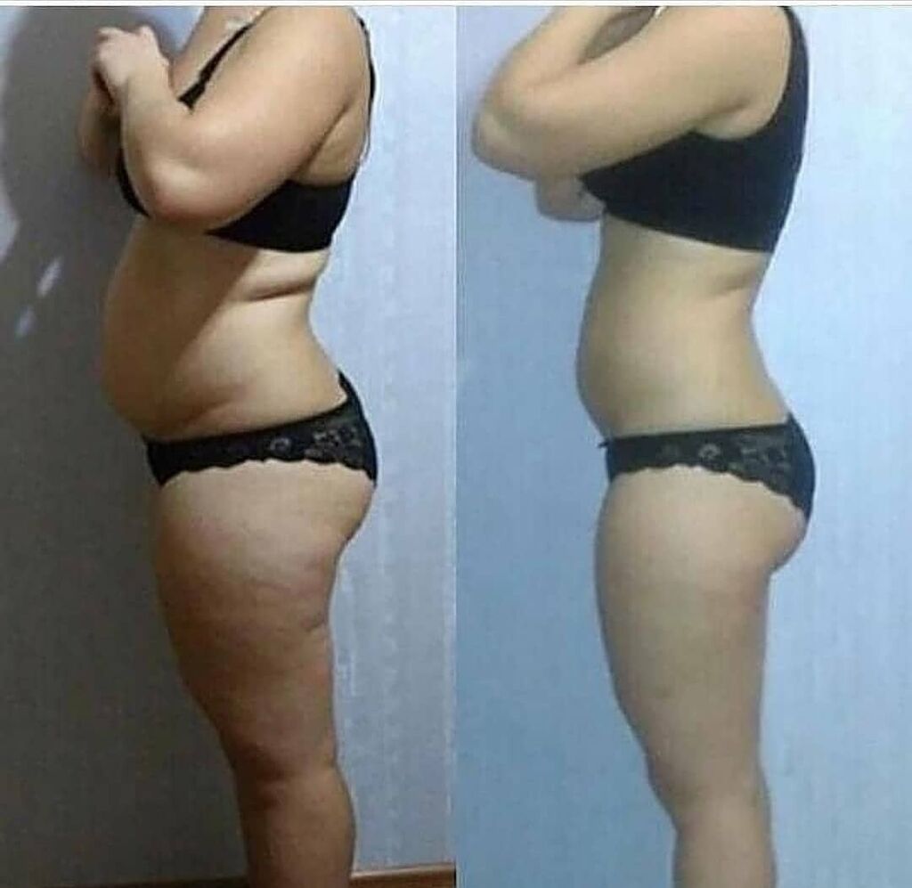 ожирение лфк. похудение с 70 до 50. до и после похудения на 20 кг. похудеть за месяц. похудение до и после.